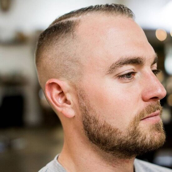 Причёски для лысеющих мужчин фото